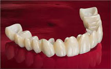 Zirconia4