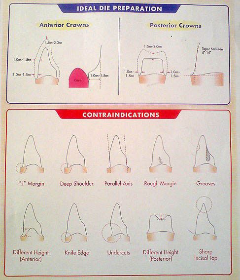 Zirconia5